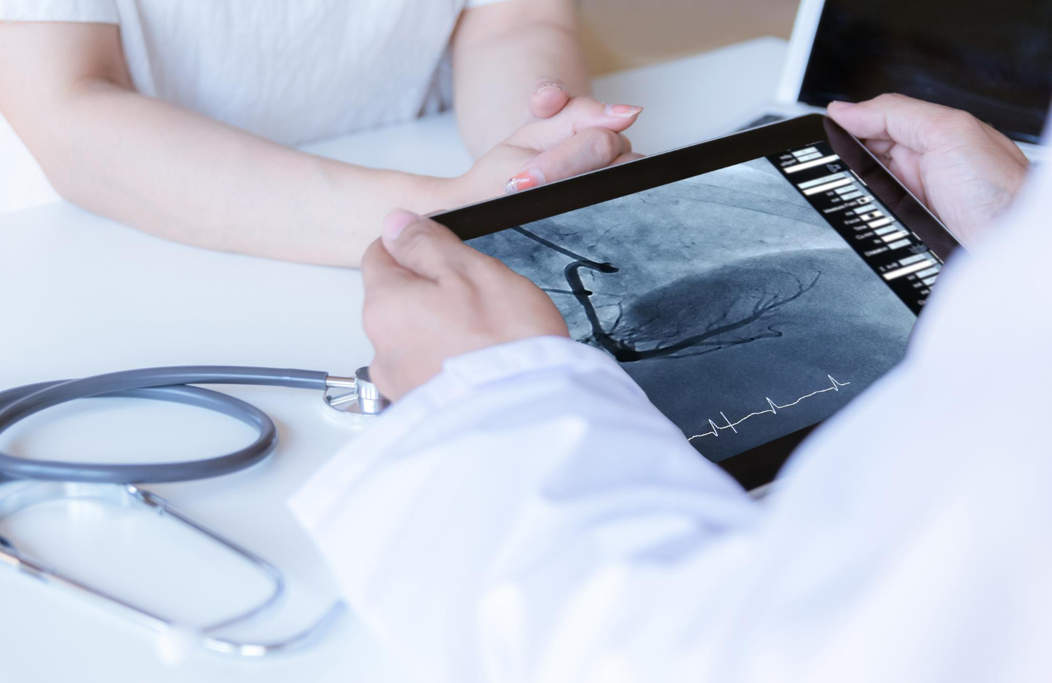 Prosedur angiografi jantung di CathLab