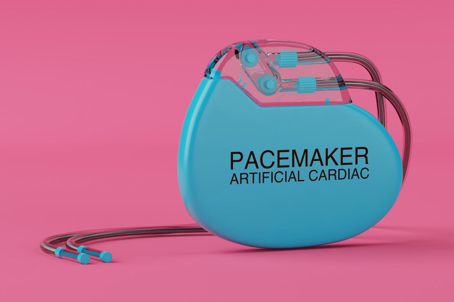 Ilustrasi pacemaker jantung